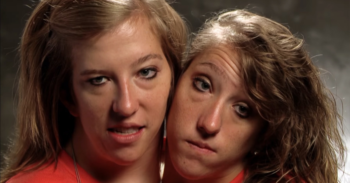 What Conjoined Twins Abby And Brittany Hensel Look Like Today Conjoined