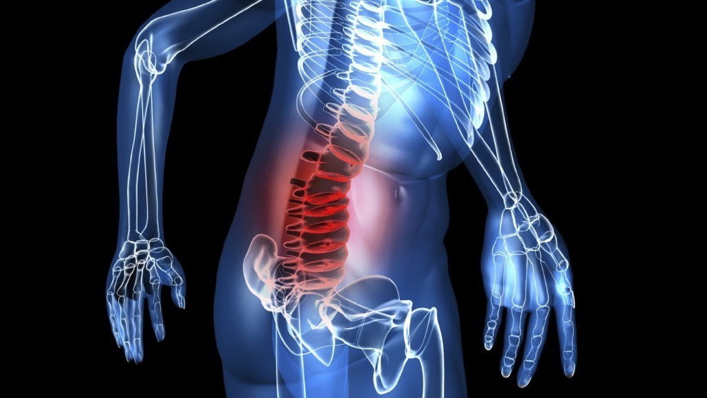 Herniated Disc (Neck And Back): Symptoms, Causes, Treatment, Relief ...