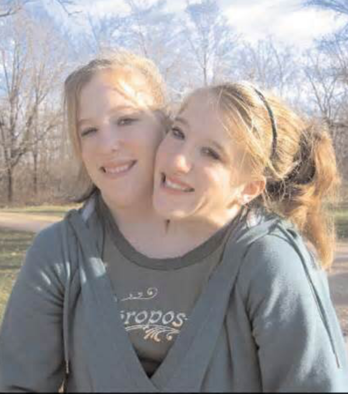 Abby abby and brittany hensel conjoined twins facesummit